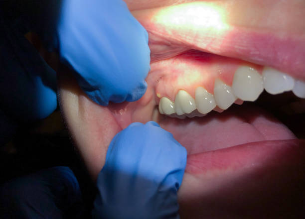 Best Emergency Broken Tooth Repair in Monte Vista, CO